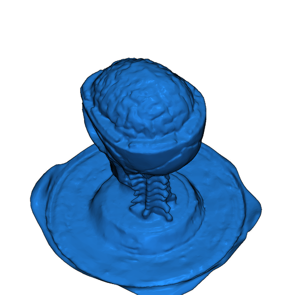 Открытый череп с мозгом