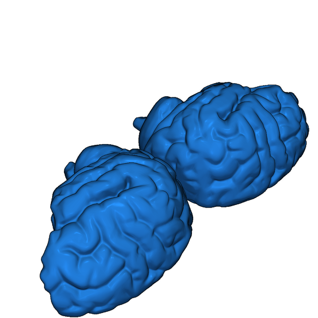 Черепная коробка