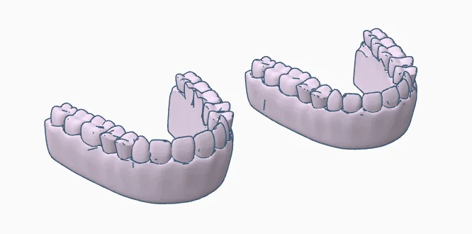 3D модель Модель зубных протезов для обучения - фото 4