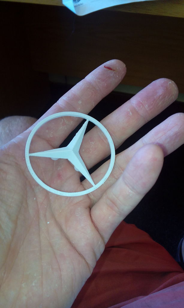 Защита на грязевых дорогах - подкрылки для Mercedes