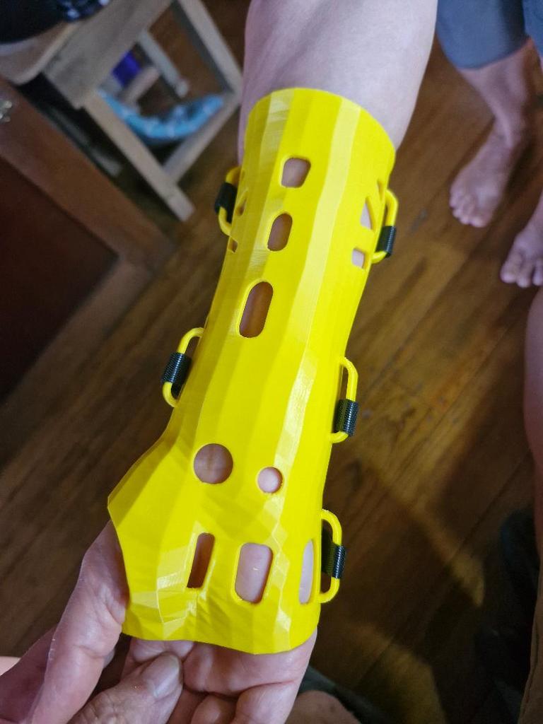 Шина для запястья