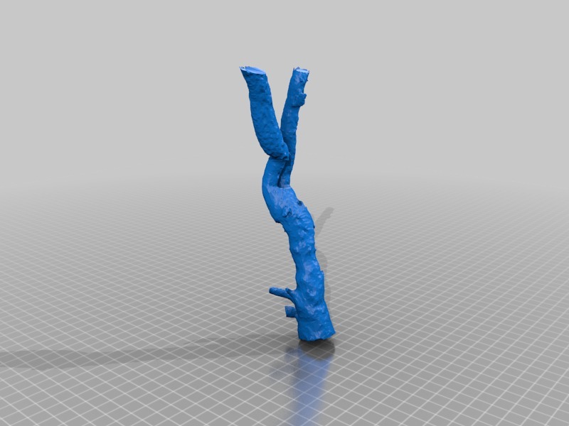 3D модель аортального бифуркационного сегмента